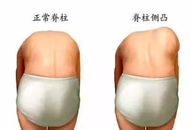 寶寶身高原來與脊椎發(fā)育有關(guān),有些動(dòng)作要注意！