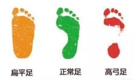 扁平足是有機(jī)會(huì)矯正的 你給孩子買對(duì)鞋了嗎