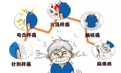 專家教你科學(xué)防治帶狀皰疹 小小水泡為何讓人痛不欲生？