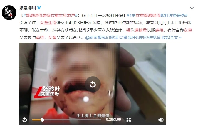 4歲女童疑遭繼母毆打重傷進(jìn)ICU：虐童案頻發(fā)，除了憤怒我們更應(yīng)該站出來