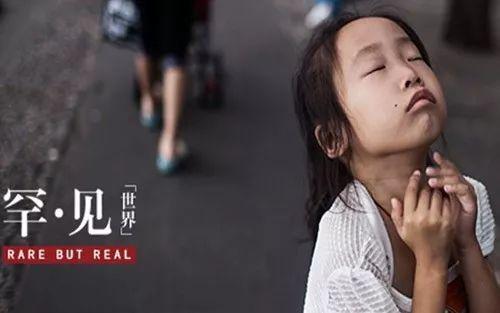 人大代表建議將兒童罕見(jiàn)病用藥納入醫(yī)保 什么是罕見(jiàn)病?