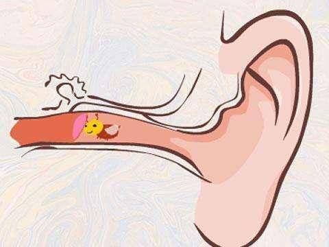 科學預防丨小孩耳朵進了蟲子家長應該怎么做?