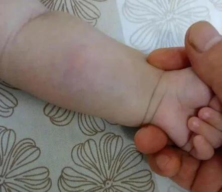 天降煙灰杯砸中杭州3月大女嬰 禁高空拋物需大家共勉