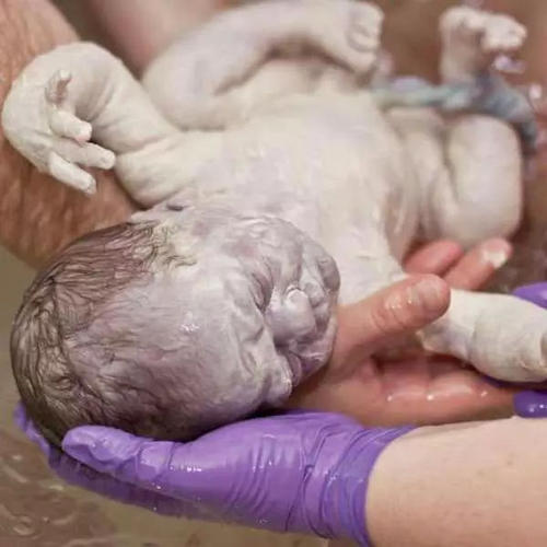 寶寶剛出生時(shí)身上一層白白的是什么？需要清理嗎？