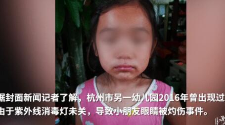 杭州小學(xué)誤開(kāi)紫外線燈灼傷學(xué)生眼睛 官方：電工操作失誤
