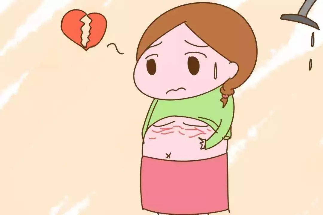 令人煩惱的妊娠紋，怎么才能預(yù)防呢？