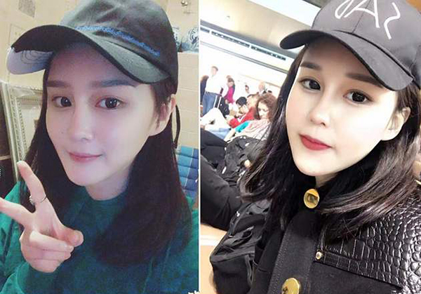 趙本山女兒撞臉李小璐？竟花30萬做鼻子！