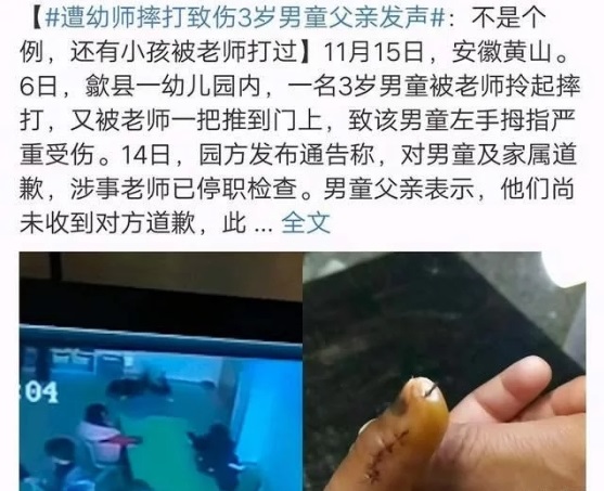 得知孩子被虐待，寶爸怒打幼師，園方袒護(hù)老師不道歉不讓報(bào)警
