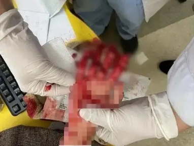 趁媽媽不注意，女孩將手伸進(jìn)了絞肉機(jī)，血的教訓(xùn)！