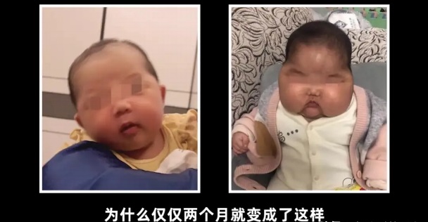 “大頭娃娃”重現(xiàn)，原因竟然是嬰兒霜激素超標