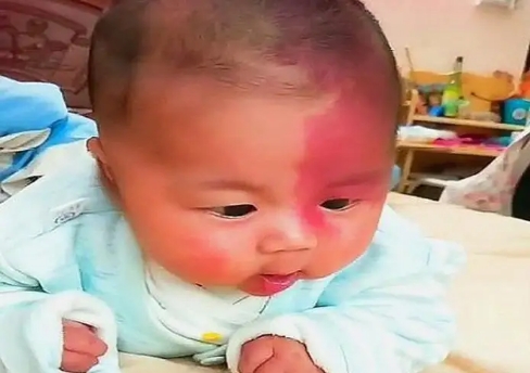 為了避免新生兒有胎記，孕期準媽媽最好避開這3種行為