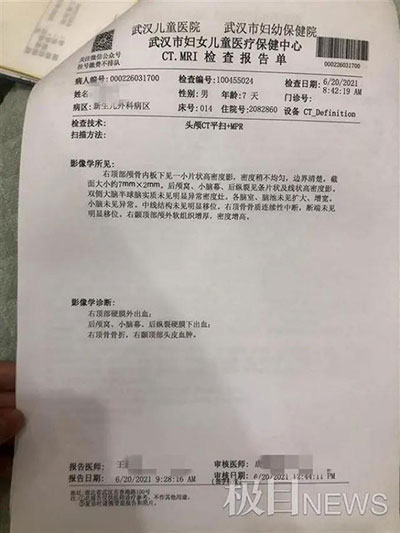 痛心！出生6天寶寶被月嫂摔成顱骨骨折