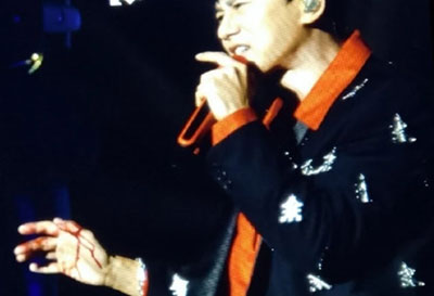 張杰舞臺(tái)事故受傷，去醫(yī)院前還在關(guān)心是否嚇到了孩子