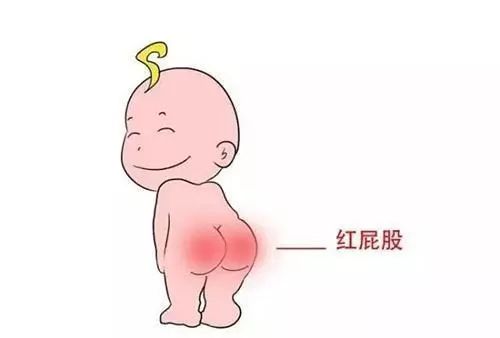 做好這三點(diǎn)，寶寶遠(yuǎn)離“紅屁股”
