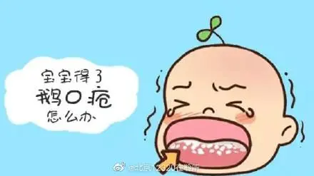 什么是新生兒鵝口瘡？