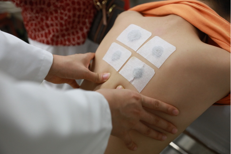 三伏貼開(kāi)貼！高溫天對(duì)三伏貼效果增加助力