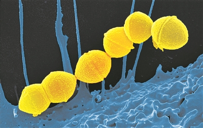 “食人菌”真的會(huì)“吃人”？